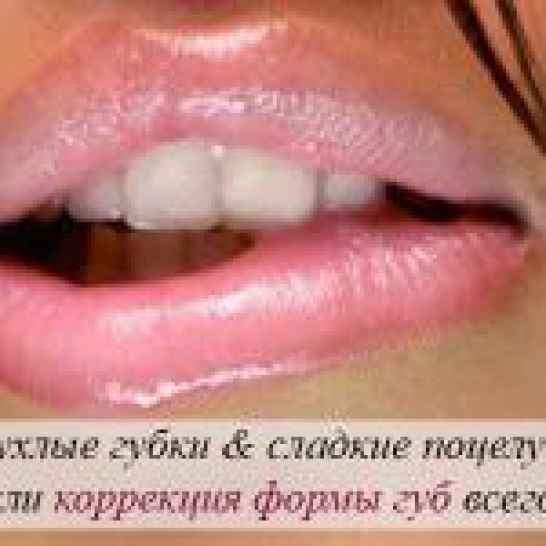 Контурная пластика губ (увеличение губ)