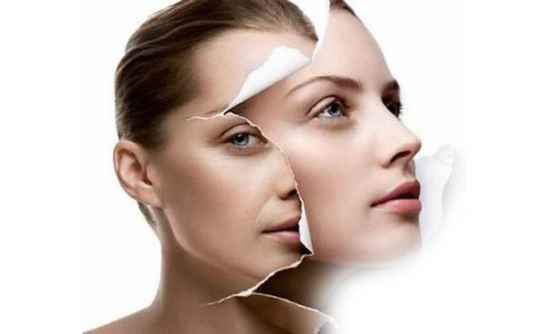 Лазерный плазмолифтинг