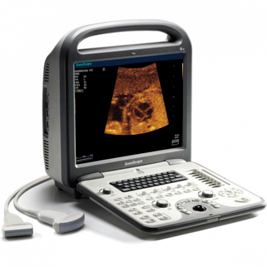 Ультразвуковой сканер S6N (ВЕТ)