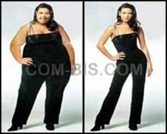 Контрактное лечение ожирения